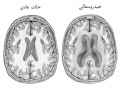 تصویر بندانگشتی از نسخهٔ مورخ ‏۲۱ مهٔ ۲۰۱۷، ساعت ۰۵:۴۶